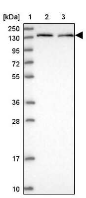 Western Blot: HEATR7A Antibody [NBP1-93571]