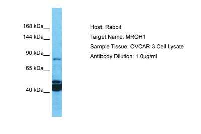 Western Blot: HEATR7A Antibody [NBP2-83037]