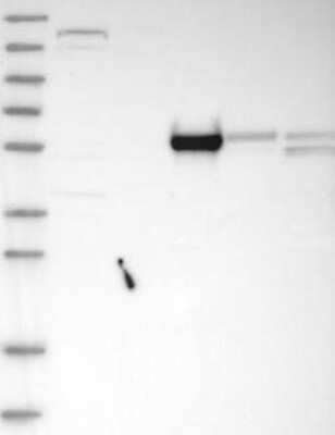 Western Blot: HEATR7A Antibody [NBP3-17503]