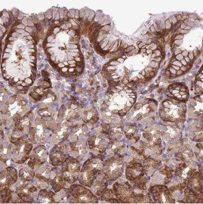 Immunohistochemistry-Paraffin: HEATR7B1 Antibody [NBP2-14761]