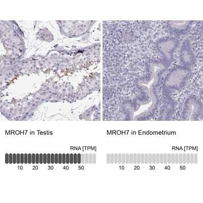 Immunohistochemistry-Paraffin: HEATR8 Antibody [NBP2-62673]