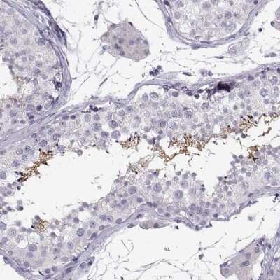 Immunohistochemistry-Paraffin: HEATR8 Antibody [NBP2-62673]