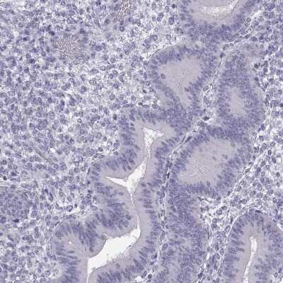 Immunohistochemistry-Paraffin: HEATR8 Antibody [NBP2-62673]