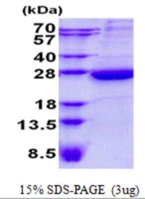 SDS-PAGE: Recombinant Human HEBP1 His Protein [NBP2-23109]