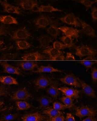 Immunocytochemistry/ Immunofluorescence: HEBP2 Antibody - Azide and BSA Free [NBP3-04517]