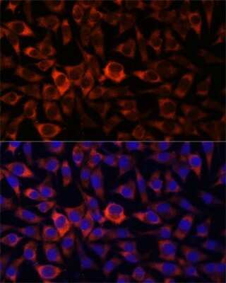 Immunocytochemistry/ Immunofluorescence: HEBP2 Antibody - Azide and BSA Free [NBP3-04517]