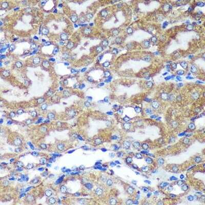 Immunohistochemistry-Paraffin: HEBP2 Antibody - Azide and BSA Free [NBP3-04517]