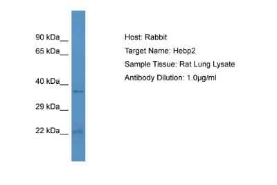 Western Blot: HEBP2 Antibody [NBP2-85037]