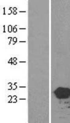 Western Blot: HEBP2 Overexpression Lysate [NBL1-11498]