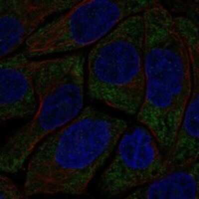 Immunocytochemistry/ Immunofluorescence: HECA Antibody [NBP3-17379]