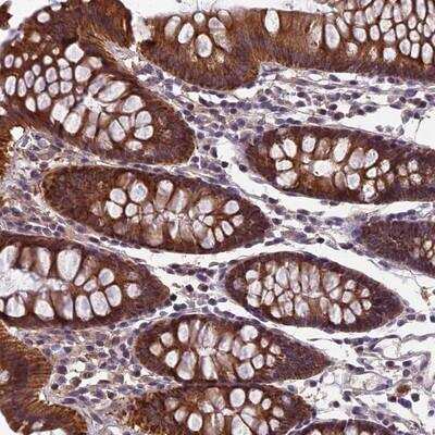 Immunohistochemistry-Paraffin: HECA Antibody [NBP1-85189]