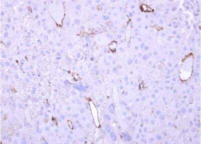 Immunohistochemistry-Paraffin: HECA Antibody [NBP2-16800]