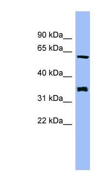 Western Blot: HECA Antibody [NBP1-58113]