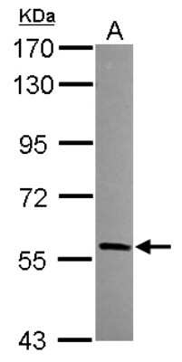 Western Blot: HECA Antibody [NBP2-16800]