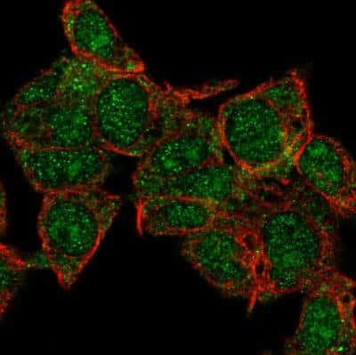 Immunocytochemistry/ Immunofluorescence: HECTD1 Antibody [NBP1-82926]