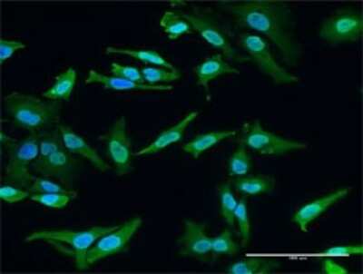 Immunocytochemistry/ Immunofluorescence: HECTD2 Antibody (3D6) [H00143279-M01]