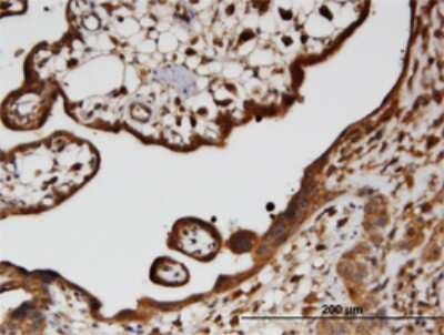 Immunohistochemistry-Paraffin: HECTD2 Antibody (3D6) [H00143279-M01]