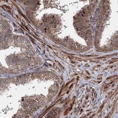 Immunohistochemistry-Paraffin: HECTD2 Antibody [NBP1-83481]