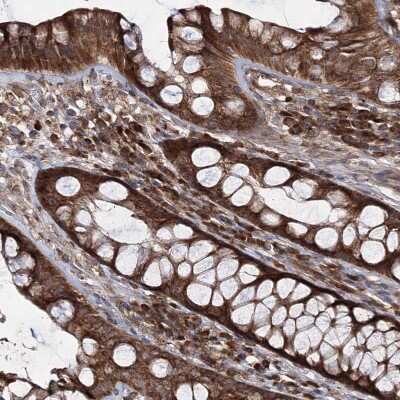 Immunohistochemistry-Paraffin: HECTD2 Antibody [NBP1-83481]