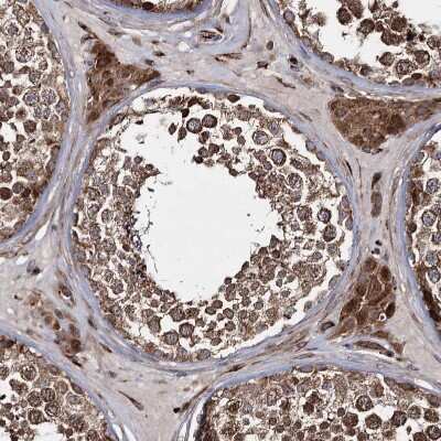 Immunohistochemistry-Paraffin: HECTD2 Antibody [NBP1-83481]