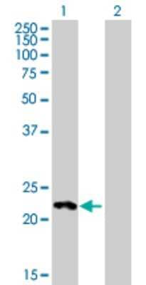 Western Blot: HECTD2 Antibody [H00143279-B01P]