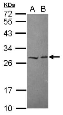 Western Blot: HECTD2 Antibody [NBP2-16801]