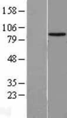 Western Blot: HECTD2 Overexpression Lysate [NBL1-11499]