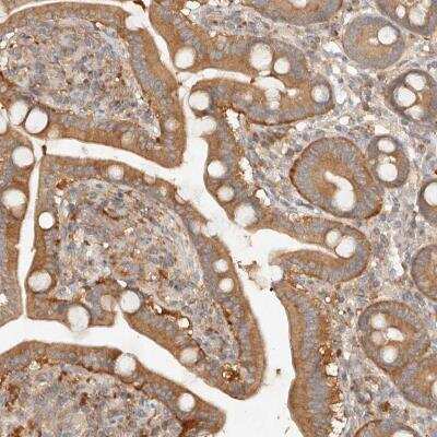 Immunohistochemistry-Paraffin: HECTD3 Antibody [NBP1-82153]