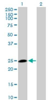 Western Blot: HECTD3 Antibody [H00079654-B01P]