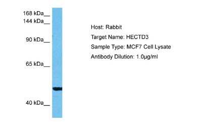 Western Blot: HECTD3 Antibody [NBP2-85039]