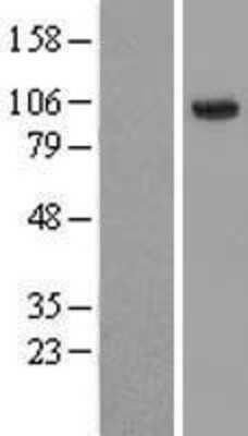 Western Blot: HECTD3 Overexpression Lysate [NBL1-11500]