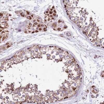 Immunohistochemistry-Paraffin: HECTD4 Antibody [NBP2-30697]