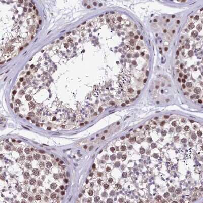Immunohistochemistry-Paraffin: HECTD4 Antibody [NBP2-30719]