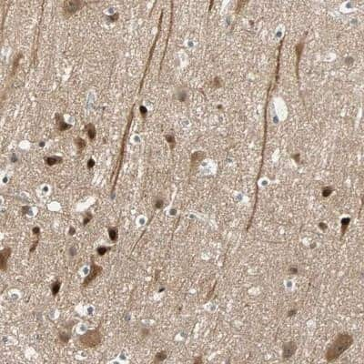 Immunohistochemistry-Paraffin: HECW1 Antibody [NBP1-93644]