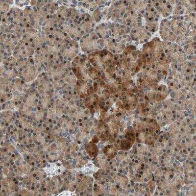 Immunohistochemistry-Paraffin: HECW1 Antibody [NBP1-93645]