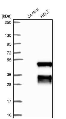 Western Blot: HELT Antibody [NBP1-90761]