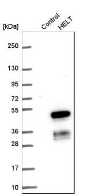 Western Blot: HELT Antibody [NBP2-38288]