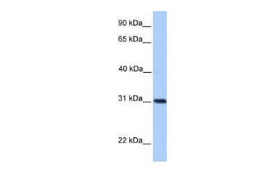 Western Blot: HELT Antibody [NBP2-85041]