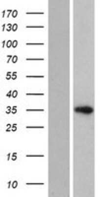 Western Blot: HELT Overexpression Lysate [NBP2-08601]