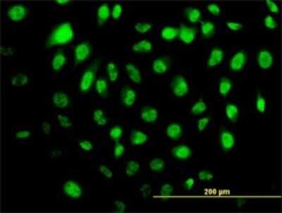 Immunocytochemistry/ Immunofluorescence: HELZ Antibody (5B2) [H00009931-M02]