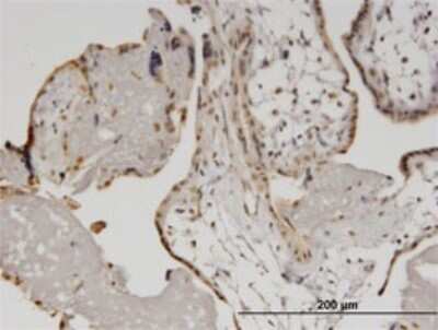 Immunohistochemistry-Paraffin: HELZ Antibody (5B2) [H00009931-M02]