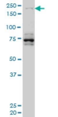 Western Blot: HELZ Antibody (5B2) [H00009931-M02]