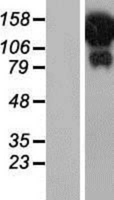 Western Blot: HELZ Overexpression Lysate [NBP2-07259]