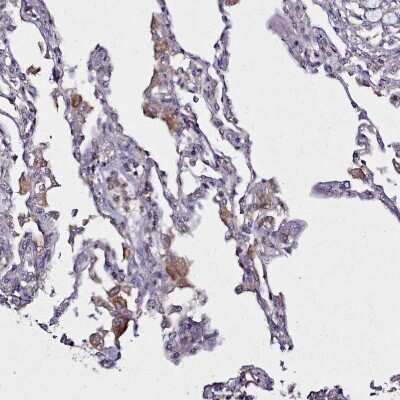 Immunohistochemistry-Paraffin: HEM1 Antibody [NBP2-13643]