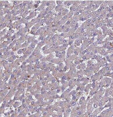 Immunohistochemistry-Paraffin: HEM1 Antibody [NBP2-13643]