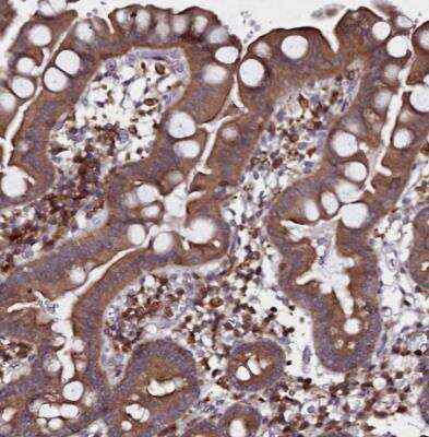 Immunohistochemistry-Paraffin: HEM1 Antibody [NBP2-13643]