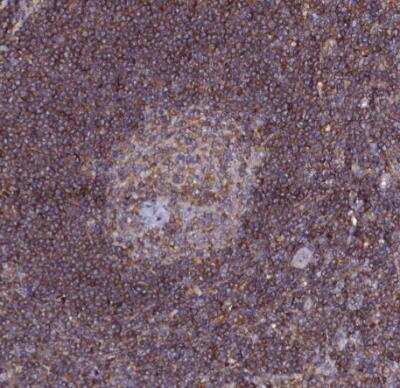 Immunohistochemistry-Paraffin: HEM1 Antibody [NBP2-13643]