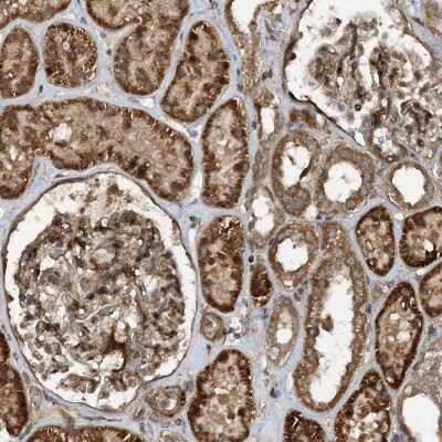 Immunohistochemistry-Paraffin: HEMK1 Antibody [NBP1-81020]