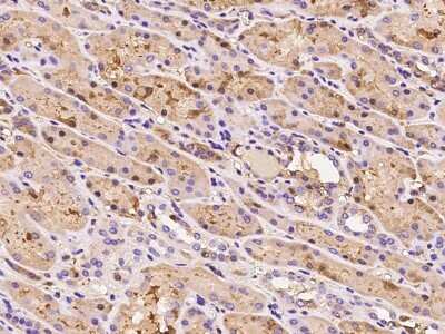 Immunohistochemistry-Paraffin: HEMK1 Antibody [NBP2-99210]