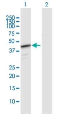 Western Blot: HEMK1 Antibody [H00051409-D01P]